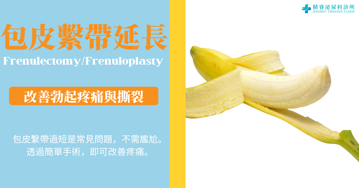 包皮繫帶延長／切除手術｜改善勃起疼痛、撕裂與性生活不適 photo